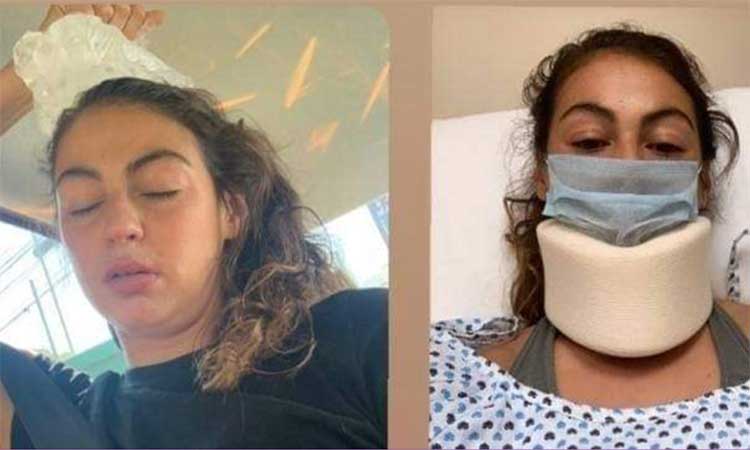 Christina Burkenroad y Mónica Flores sufren accidente automovilístico 